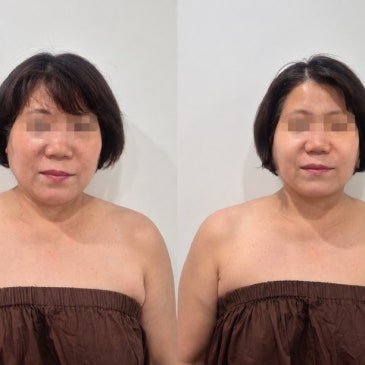 얼굴 윤곽, 얼굴만 관리하지 않습니다|두피부터 시작하는 윤곽 브레인 밸런스 - 고운온도 블로그